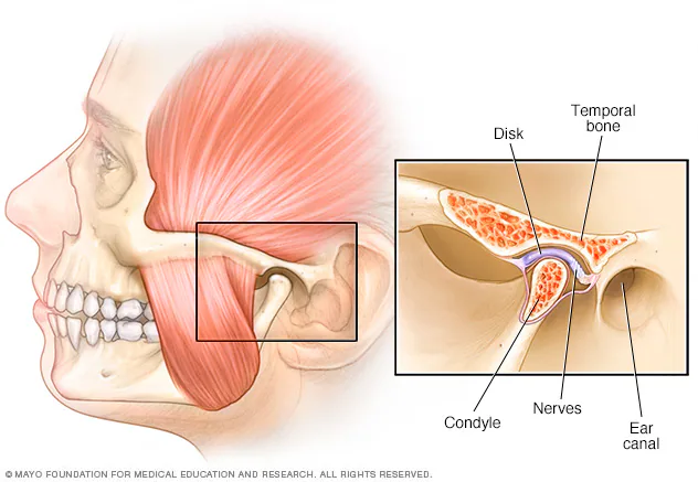 Why Do My Teeth Feel Bruised in the Morning? 7 Common Causes and What You Can Do - 2 Why Do My Teeth Feel Bruised in the Morning? 7 Common Causes and What You Can Do - TMJ or Jaw Tension While Sleeping
